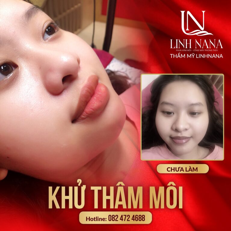 Khách hàng phun môi tại Khánh Xuân Beauty, Đông Gia Nghĩa – ảnh 02
