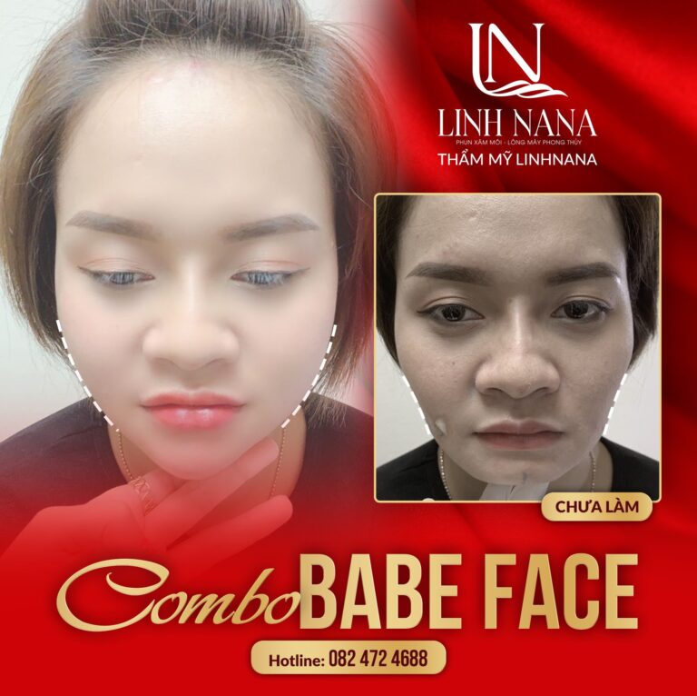 Khách hàng sử dụng dịch vụ cấy HA tại Khánh Xuân Beauty, Đông Gia Nghĩa – ảnh 04