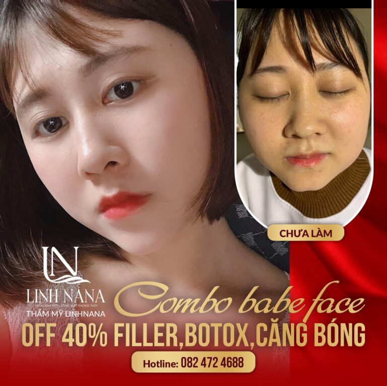 Khách hàng sử dụng dịch vụ cấy HA tại Khánh Xuân Beauty, Đông Gia Nghĩa – ảnh 07