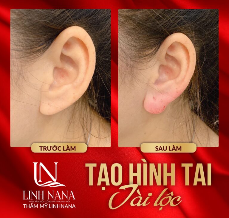 Khách hàng sử dụng dịch vụ cấy HA tại Khánh Xuân Beauty, Đông Gia Nghĩa – ảnh 03